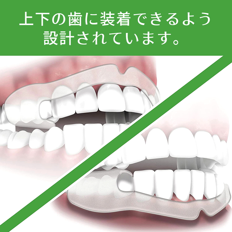 (コストコ) プラッカーズ 歯ぎしり防止イージープロテクター - 画像 (3)