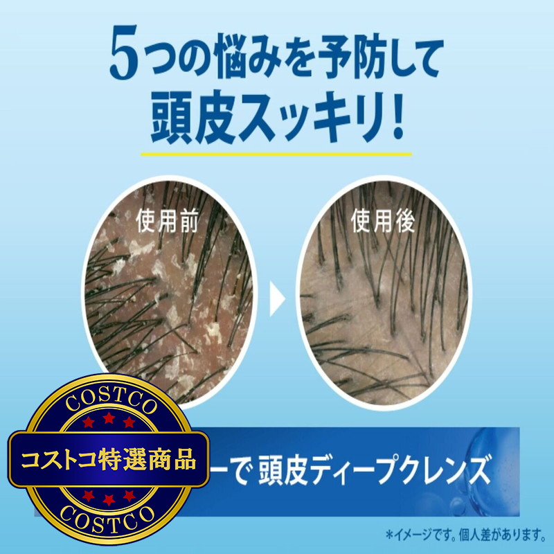 (コストコ) h&s 5in1 コンデイショナー 2000g - 画像 (3)