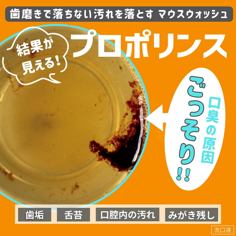 (コストコ) プロポリンス 汚れが見える マウスウォッシュ 1L x 3本セット - 画像 (2)